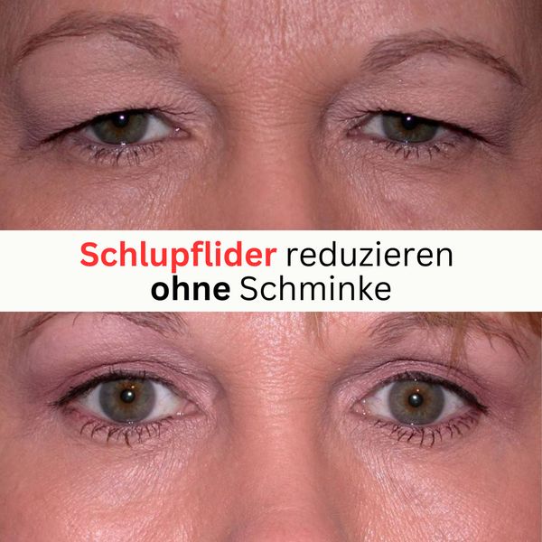 Biovolen (Apotheken Gesundheit) Health, Medical & Wellness ad example